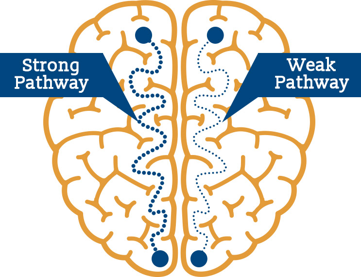 Neuroplasticity and the Recovering Brain – Alta Mira Recovery